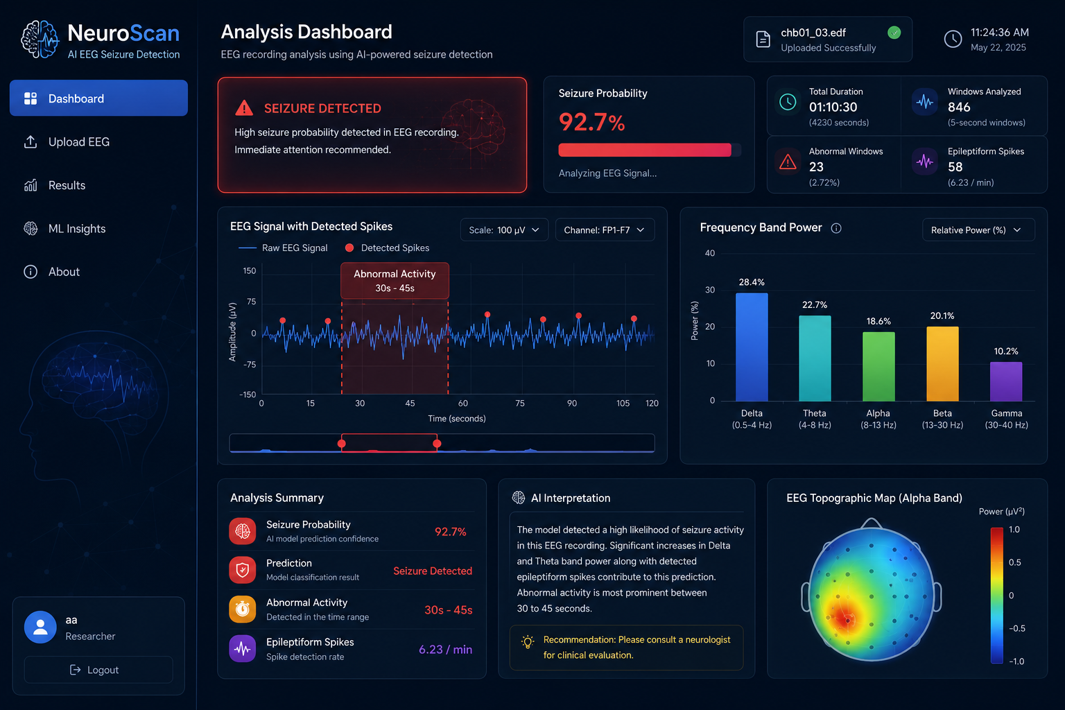 NeuroScan EEG Seizure Detection